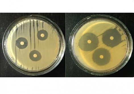 Композиты наночастиц серебра с антибиотиком могут стать антимикробными препаратами нового поколения