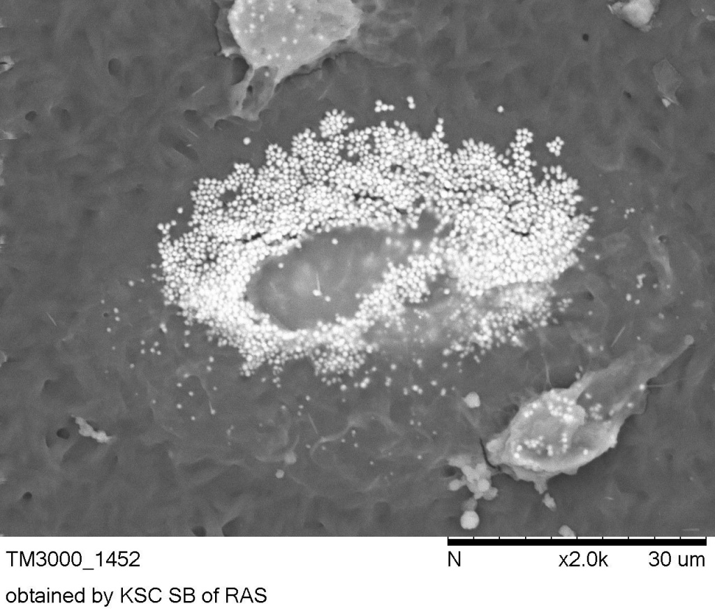 Клетка крови человека больного атеросклерозом в лабораторной культуре на подложке из биоразлагаемого полимера. Белые шарики — жировые капельки в цитоплазме.